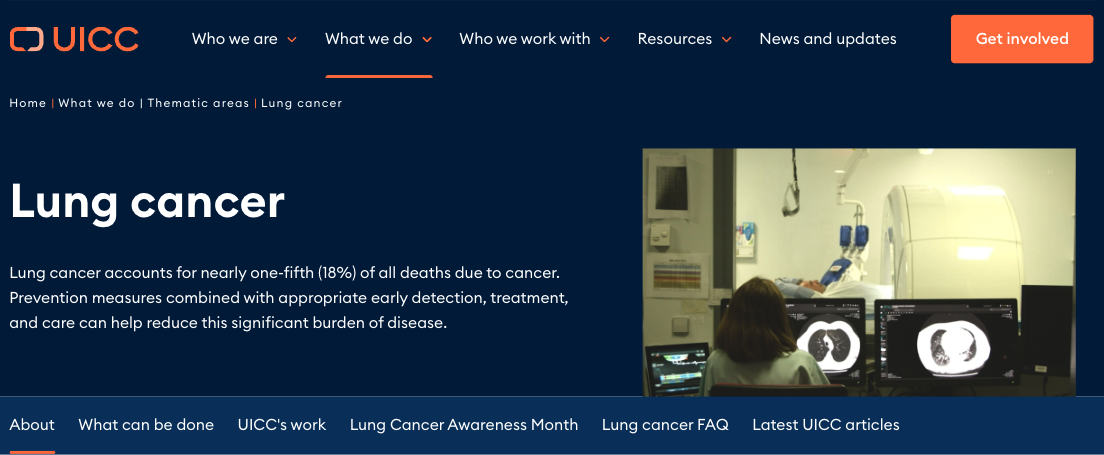 Lung cancer: UICC 