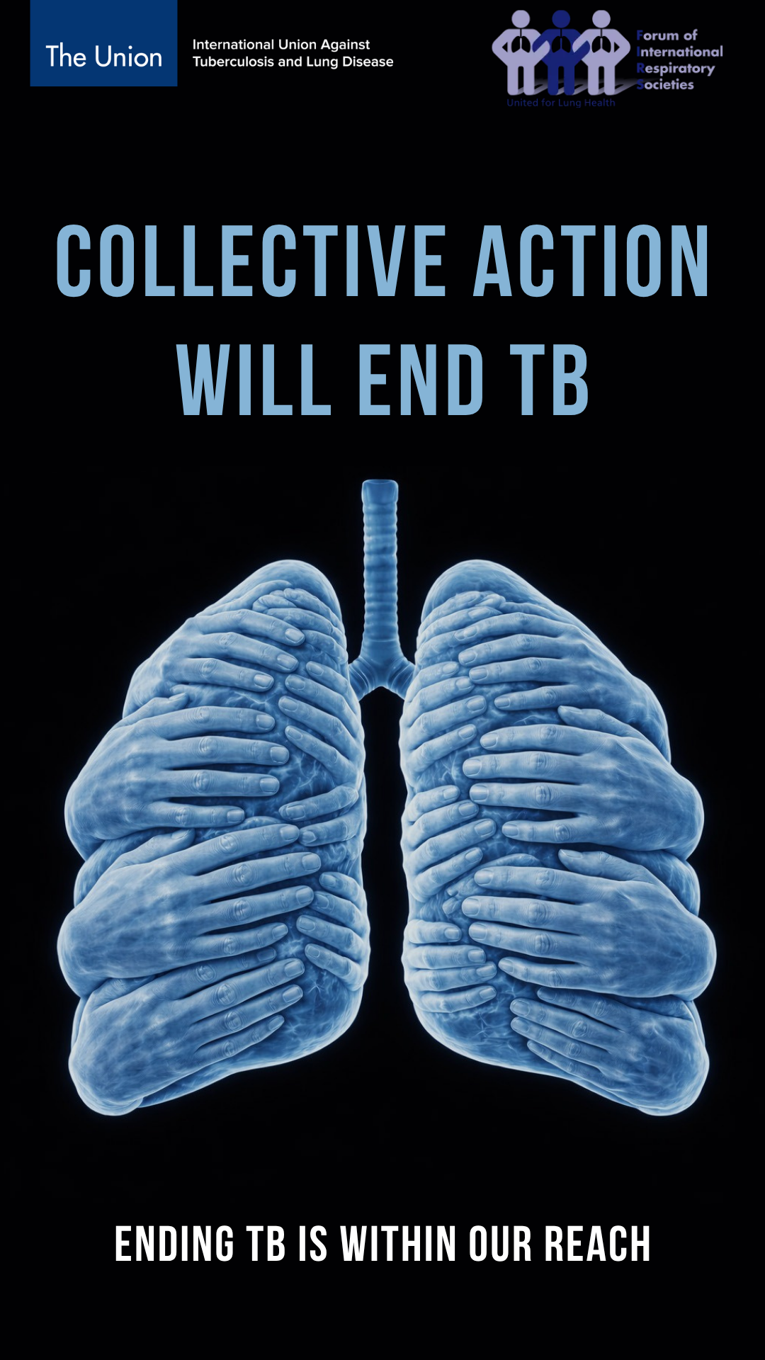 

<!-- THEME DEBUG -->
<!-- THEME HOOK: 'field' -->
<!-- FILE NAME SUGGESTIONS:
   ▪️ field--node--title--news-and-events.html.twig
   ✅ field--node--title.html.twig
   ▪️ field--node--news-and-events.html.twig
   ▪️ field--title.html.twig
   ▪️ field--string.html.twig
   ▪️ field.html.twig
-->
<!-- 💡 BEGIN CUSTOM TEMPLATE OUTPUT from 'themes/custom/whokap/templates/field/field--node--title.html.twig' -->
TB Is Not a Fact of Life: Break the Chain of Transmission – World TB Day 2026 Respiratory societies call for urgent prioritization of TB detection and treatment in high-burden settings
<!-- END CUSTOM TEMPLATE OUTPUT from 'themes/custom/whokap/templates/field/field--node--title.html.twig' -->

