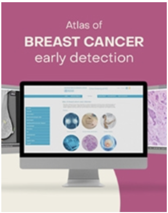 

<!-- THEME DEBUG -->
<!-- THEME HOOK: 'field' -->
<!-- FILE NAME SUGGESTIONS:
   ▪️ field--node--title--community-noticeboard.html.twig
   ✅ field--node--title.html.twig
   ▪️ field--node--community-noticeboard.html.twig
   ▪️ field--title.html.twig
   ▪️ field--string.html.twig
   ▪️ field.html.twig
-->
<!-- 💡 BEGIN CUSTOM TEMPLATE OUTPUT from 'themes/custom/whokap/templates/field/field--node--title.html.twig' -->
Online learning resources by IARC on breast cancer early detection now available in Russian
<!-- END CUSTOM TEMPLATE OUTPUT from 'themes/custom/whokap/templates/field/field--node--title.html.twig' -->

