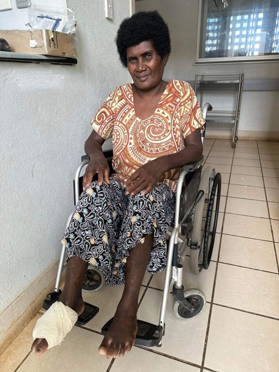 Mrs Siloute with a sore covering her foot. Photo credit: Tomoko Hamada