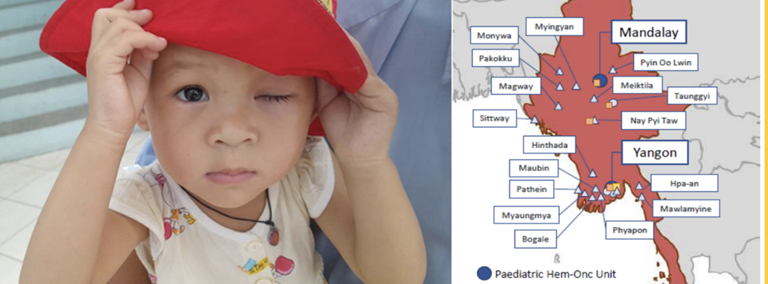 Improving care of children with cancer: Network of satellite centers and shared care in Myanmar