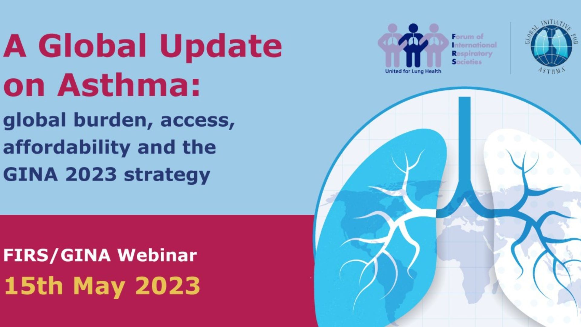 A global update on asthma: global burden, access and affordability, and the GINA 2023 strategy